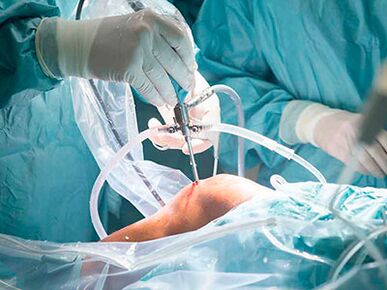 surgical treatment of arthrosis