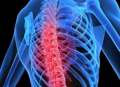 osteochondrosis of the chest
