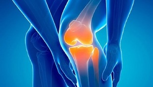 osteoarthritis of the knee