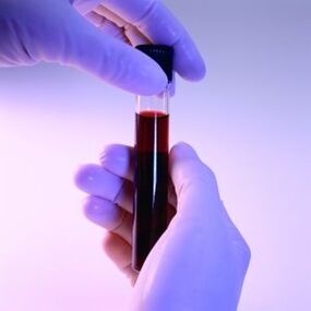 Blood in the tube